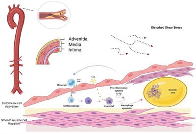 The Induction of Endothelial Autophagy and Its Role in the Development of Atherosclerosis